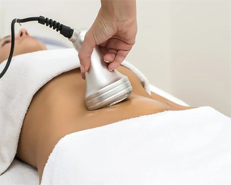 Kas yra "Lipo Cavitation